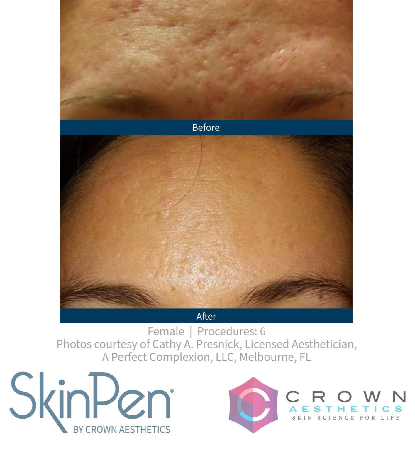 Fine Lines & Wrinkles